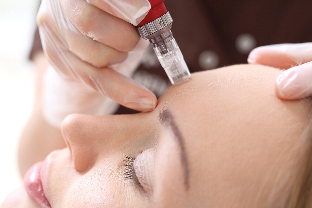 The viral microneedling collagen-inducing therapy with Exosomes at 34% off! Also, 2 other amazing skin boosting and lifting facials.