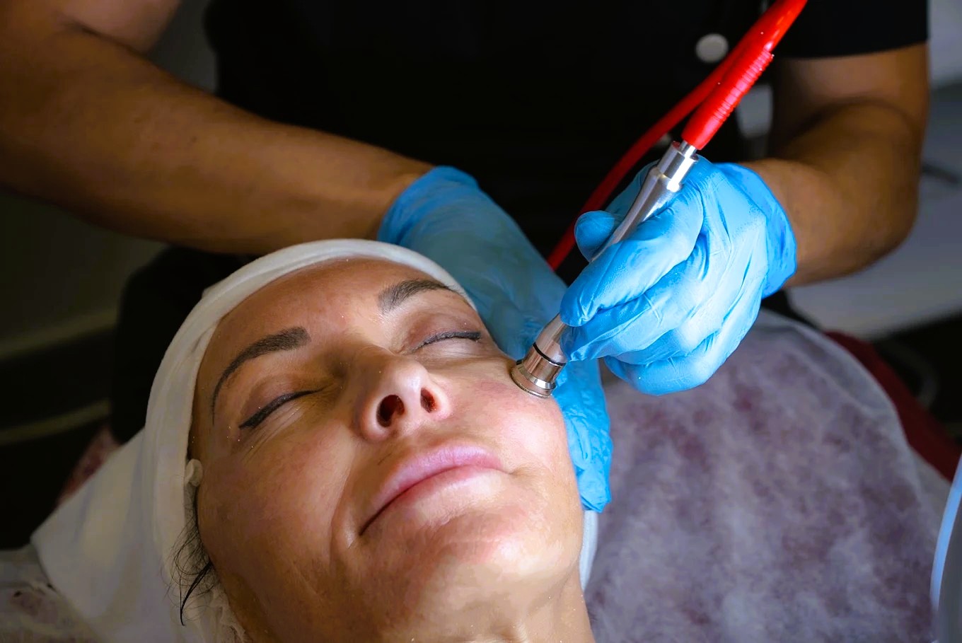 Facial cleanse with radio frequency, Craniosacral therapy and a Dermapen microneedling treatment!