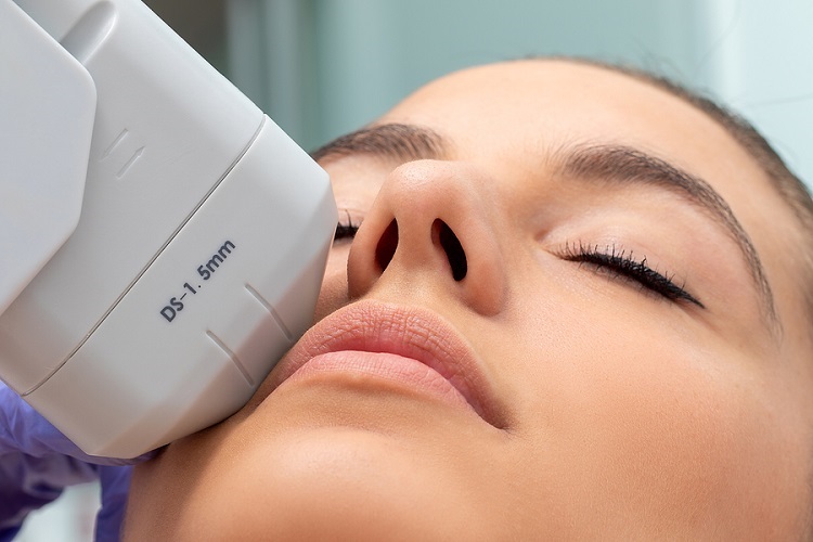 HIFU 7D Non-Invasive Facelift Treatment at Lorena Molina Advanced Aesthetics